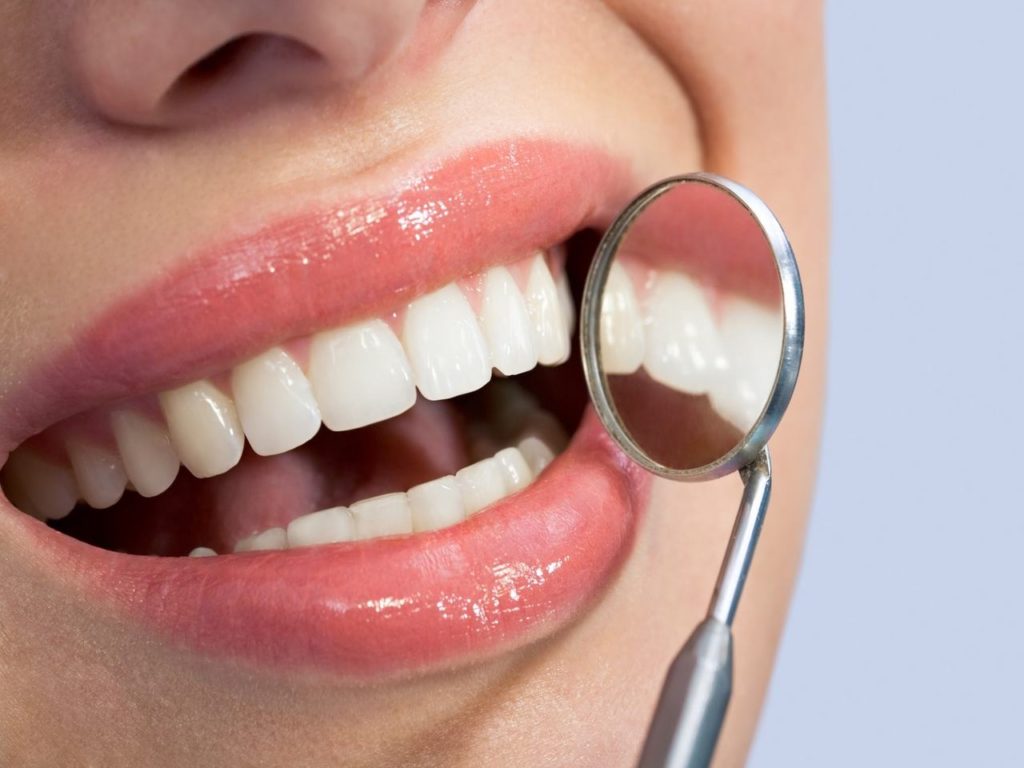 Facts on Opalescence Teeth Whitening System
