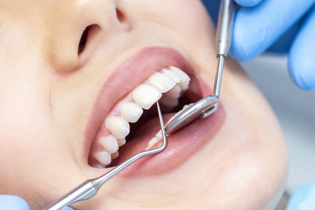 Leslie Dental  Newmarket Dentist |  The Ultimate Guide to Daily Oral Hygiene